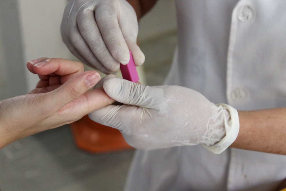 Teste rÃ¡pido HIV Aids â Foto: Caroline Aleixo/G1