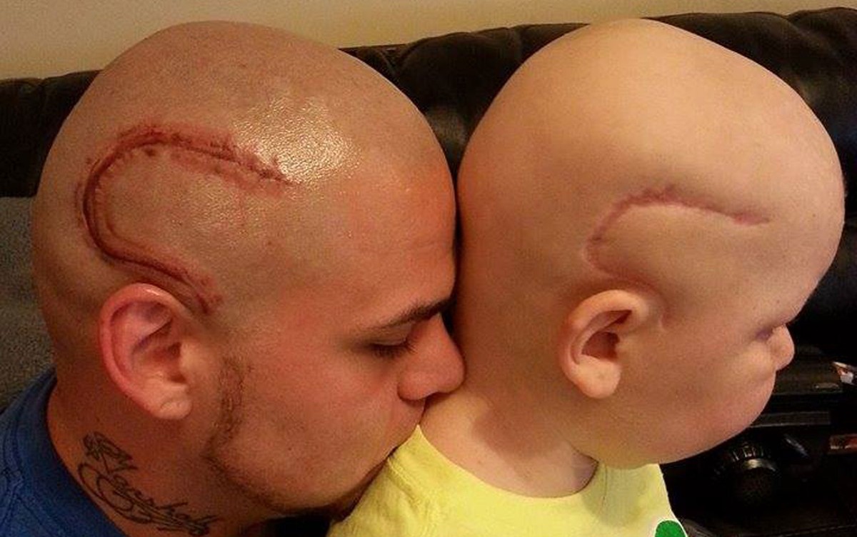 Morre Nos Eua Menino Que Inspirou Pai A Fazer Tatuagem Imitando Sua Cicatriz Mundo G1
