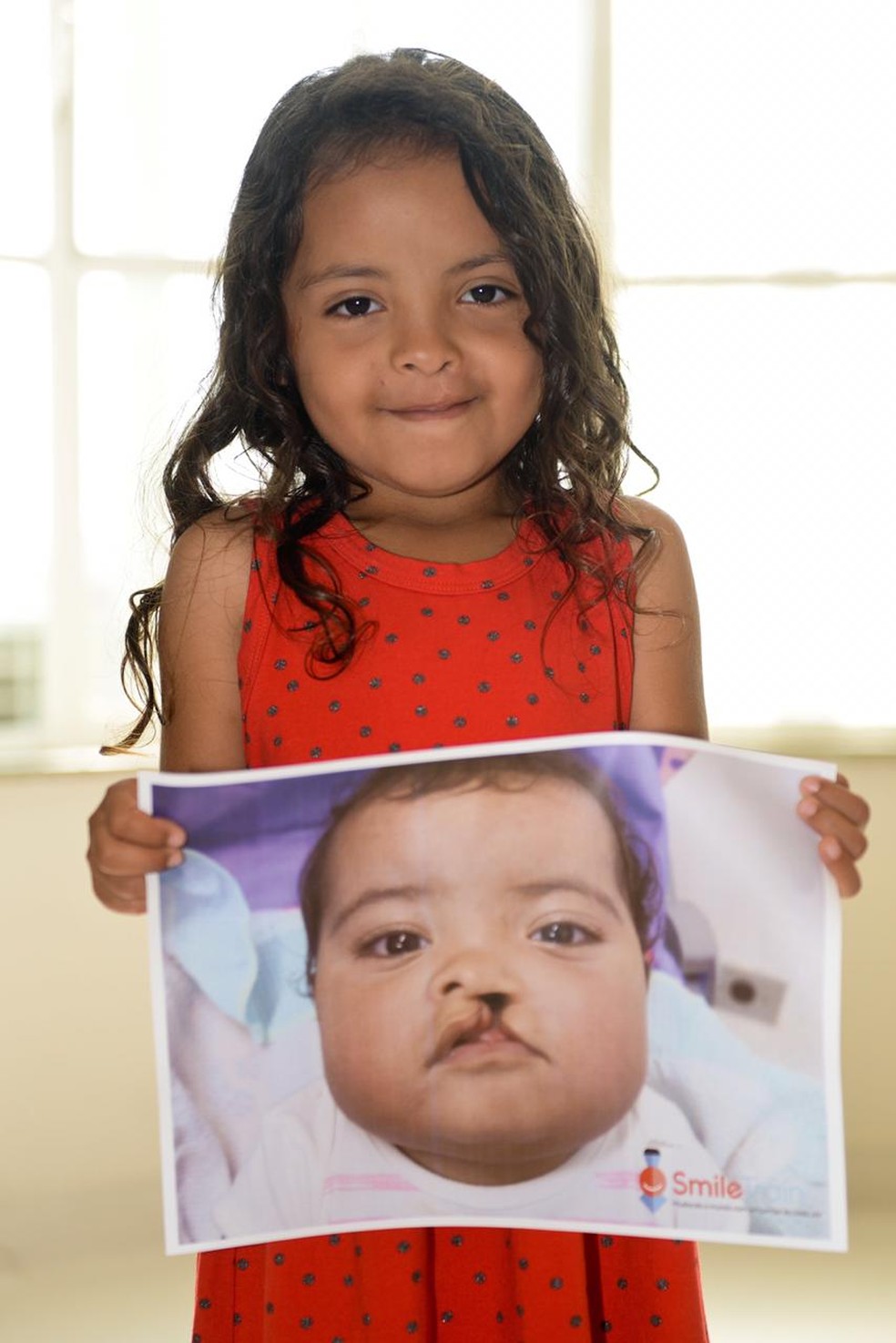Campanha ajuda crianas com lbios leporinos  Foto: Divulgao