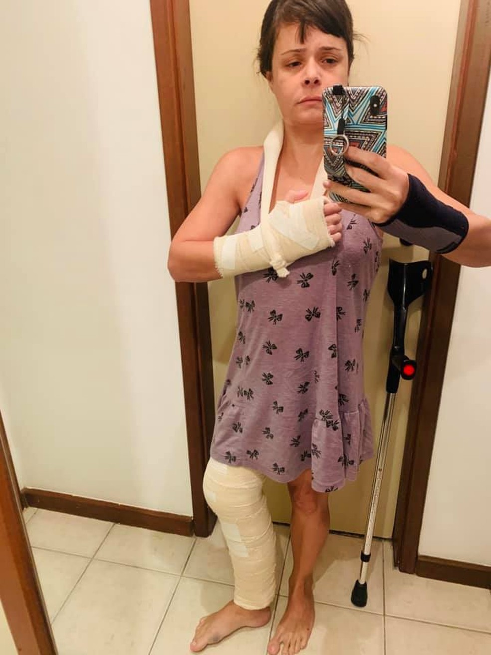 Ticyana logo após a agressão: mão pisoteada e joelho quebrado — Foto: Reprodução/redes sociais