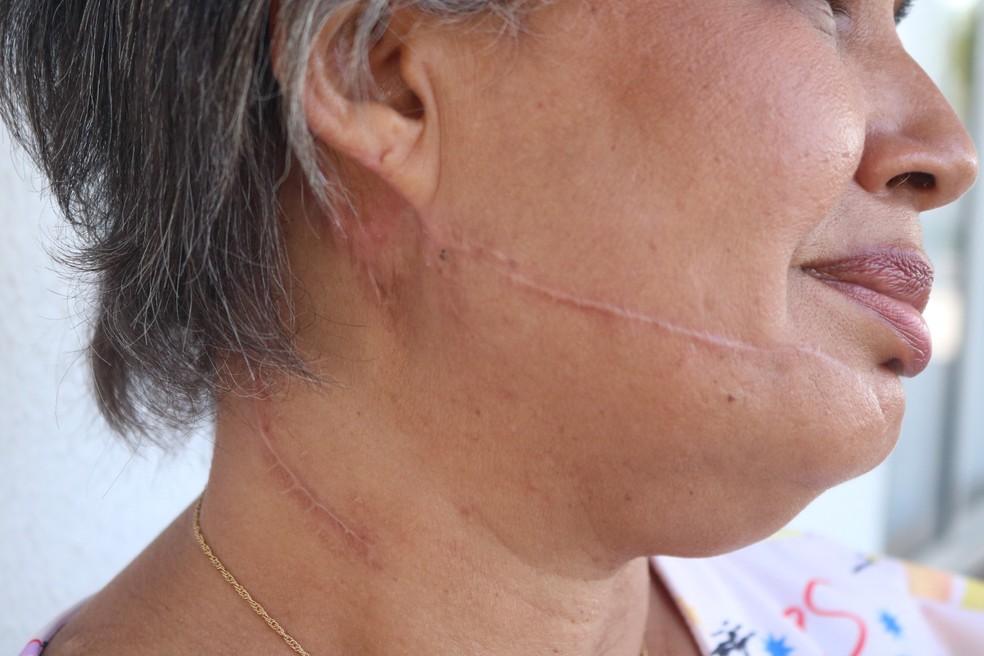 Marcas das agressões sofridas por Guilhermina Ferreira — Foto: Lucas Marreiros /g1