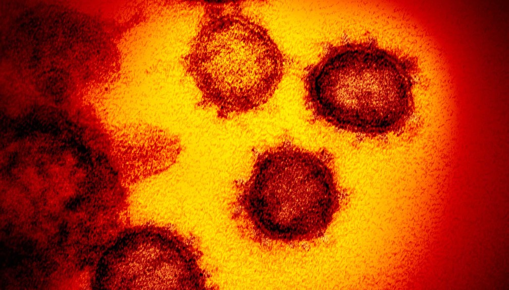Imagem de microscópico mostra o novo coronavírus, responsável pela doença chamada Covid-19 — Foto: NIAID-RML/AP