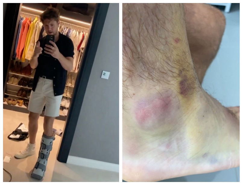 O músico Niall Horan com uma bota ortopédica após romper os ligamentos do pé (Foto: Instagram)