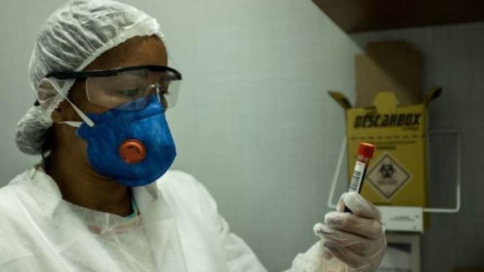 Especialistas começaram a estudar a 'pneumonia silenciosa' da covid-19 — Foto: Getty Images via BBC