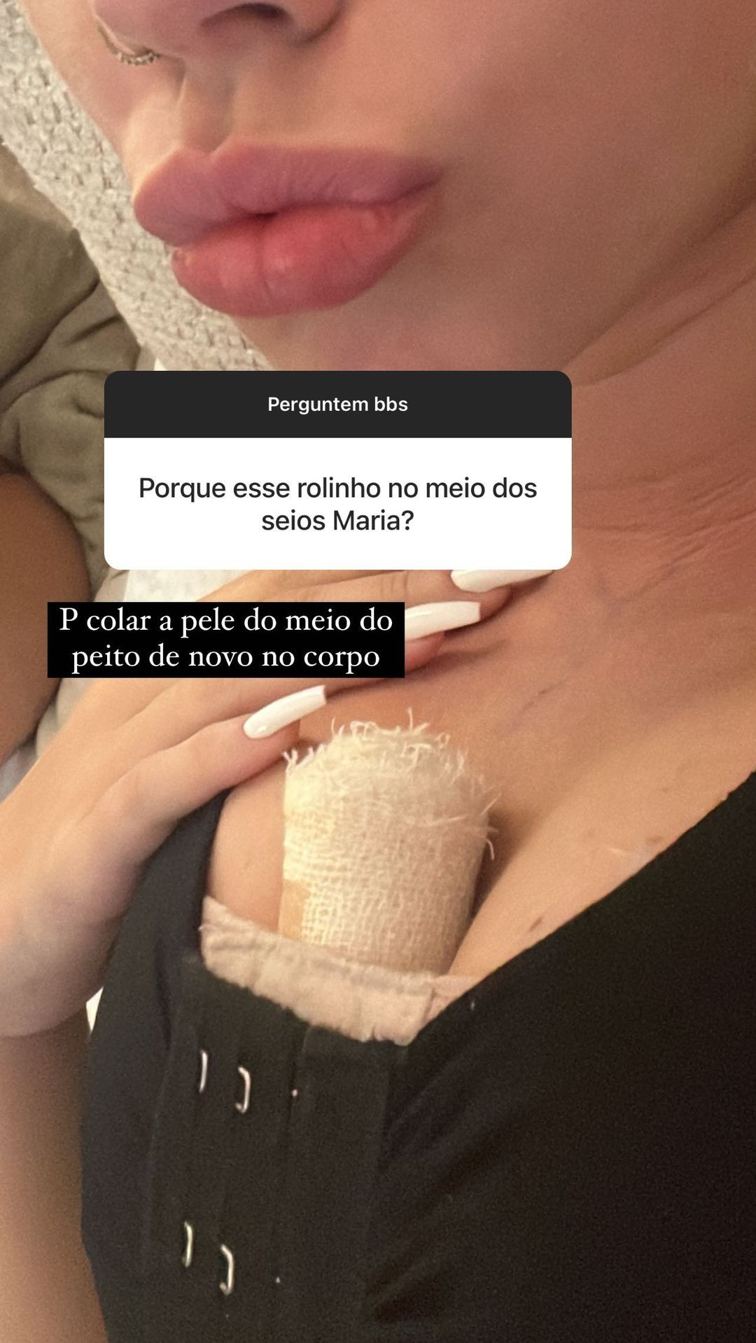 Maria Lina tira dúvidas sobre cirurgia (Foto: reprodução/instagram)