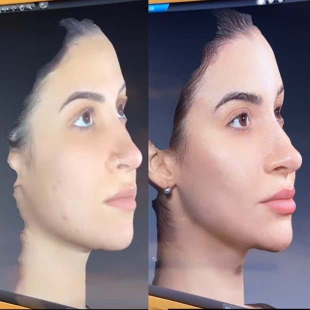 Bianca Andrade antes (em 2018) e depois (atualmente) da harmonização facial (Foto: Reprodução/Instagram)