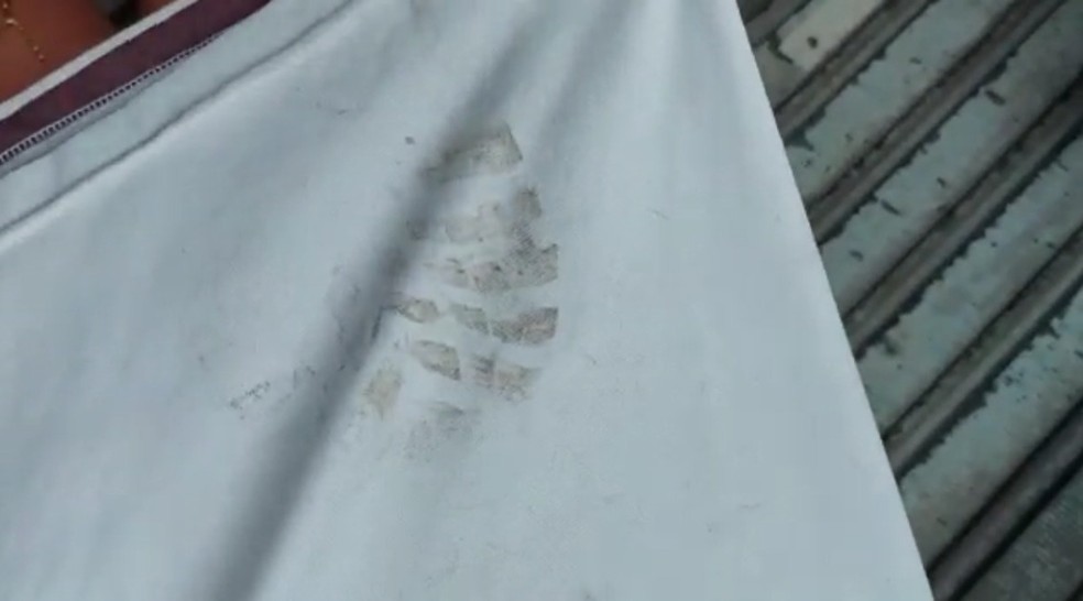 Camisa do adolescente derrubado da bicicleta por agente da Ronda no Bairro ficou com a marca da sola da bota — Foto: Reprodução/Vídeo