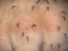 Rio Preto confirma primeiro caso de vírus da zika no ano
