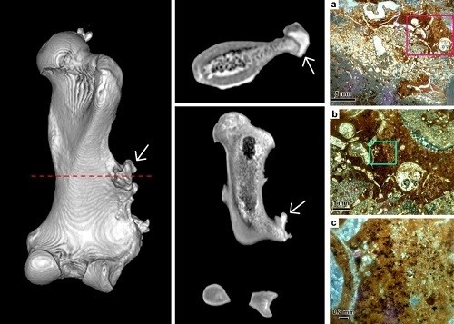Tomografia computadorizada do fêmur e imagens de microscópio mostrando o padrão de crescimento do tumor (Foto: Fernando H. de S. Barbosa/Divulgação)