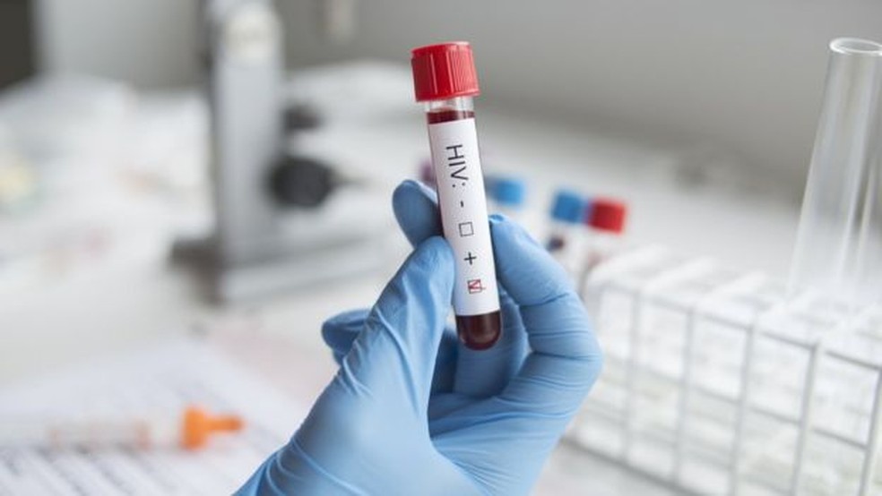 Maior oferta do teste de HIV é um fator que levou ao aumento do número de casos registrados  — Foto: Getty Images via BBC