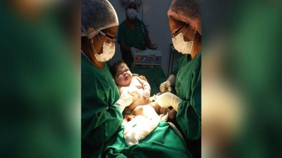 Angerson nasceu no dia 18 de janeiro deste ano de cesárea — Foto: Divulgação