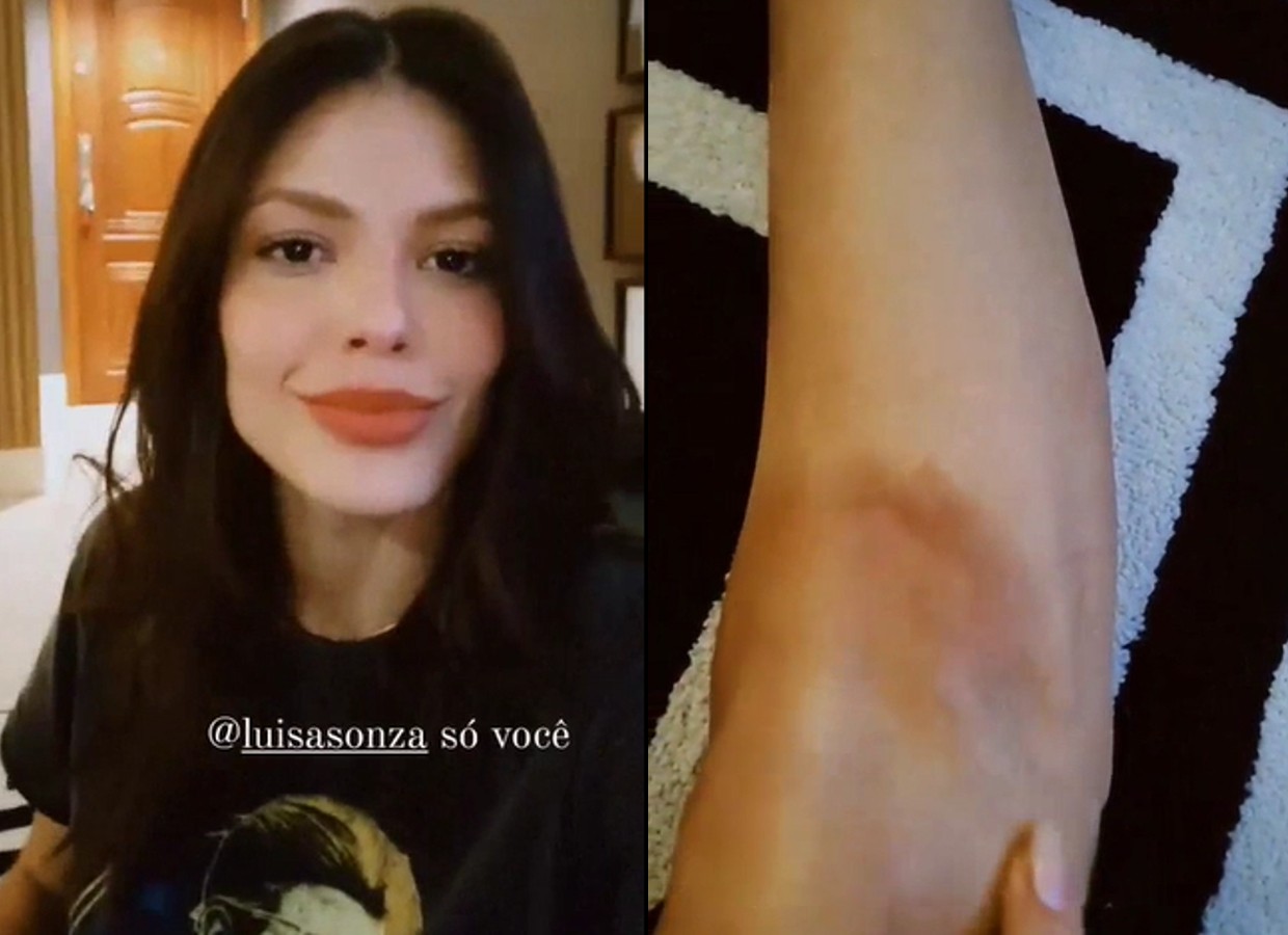 Vitória Strada mostra joelhos machucados após gravar coreografia de Cachorrinhas, novo hit de Luisa Sonza (Foto: Reprodução/Instagram)