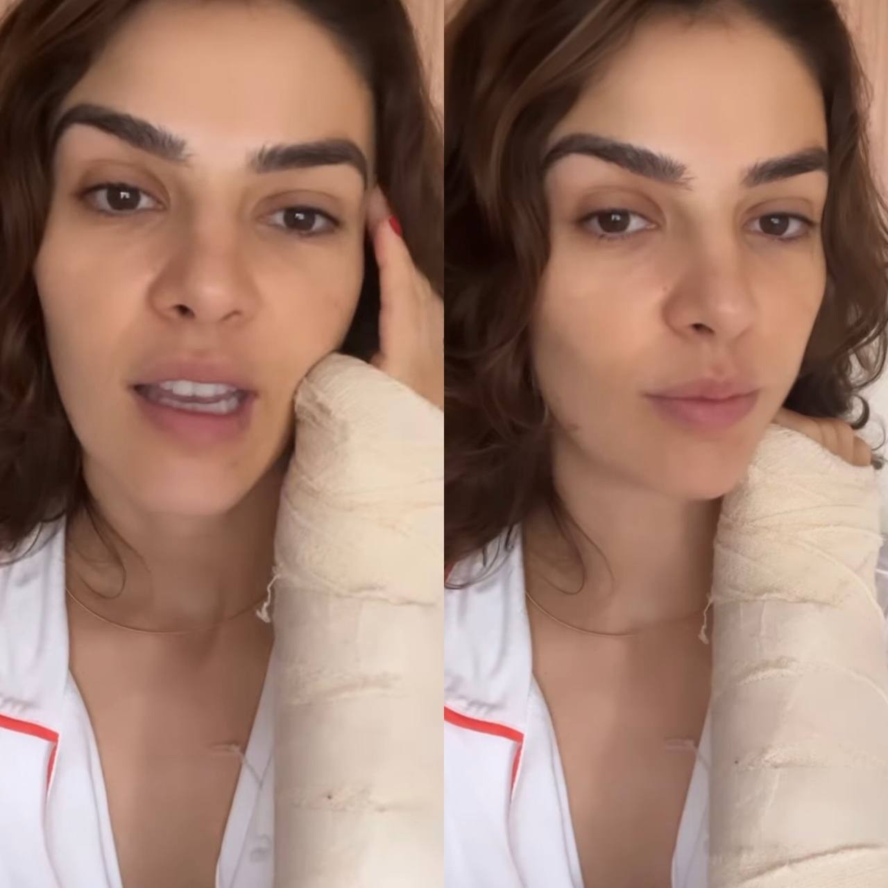'Exercício de paciência e aceitação', diz Mônica Benini sobre braço imobilizado (Foto: Reprodução / Instagram)