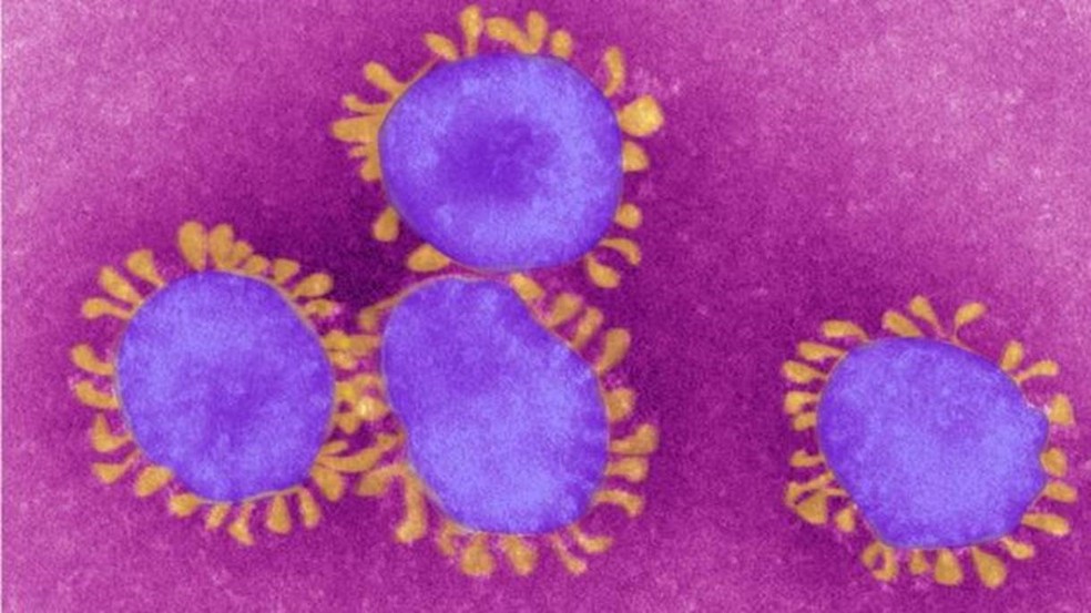 Coronavírus foram batizados assim por causa das pequenas 'coroas' na superfície — Foto: Getty Images via BBC