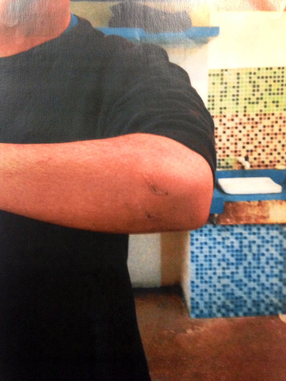 Jovem com marca de ferimento na unidade Guaianazes da Fundação Casa — Foto: Reprdução/Defensoria Pública