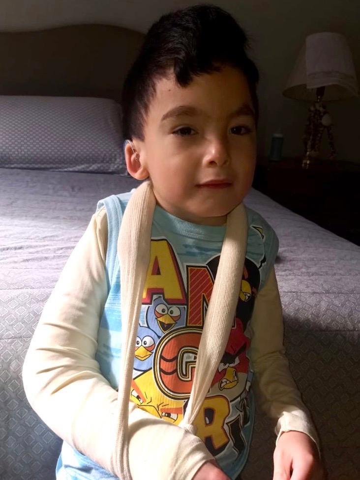 Guilherme, 7 anos, quebrou o braço após sofrer uma queda na escola. A mãe não foi comunicada (Foto: Arquivo Pessoal)