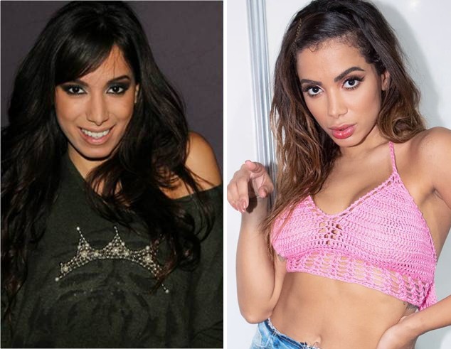 Antes e depois de Anitta (Foto: Reprodução/Instagram)