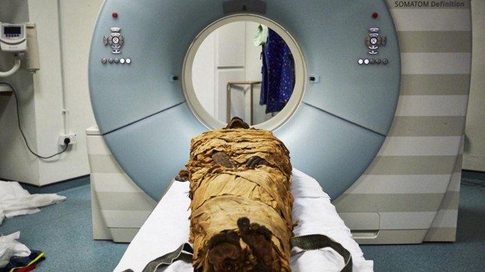 Cientistas recriam voz de múmia egípcia de 3 mil anos: ouça (Foto: Nature/Leeds Teaching Hospitals/Leeds Museums and Galleries)