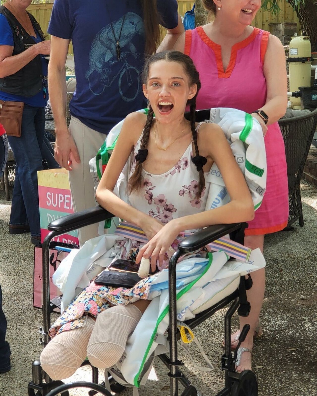 Claire Bridgers, modelo americana, tem as pernas amputadas meses após diagnóstico de covid-19 (Foto: Reprodução / Instagram)