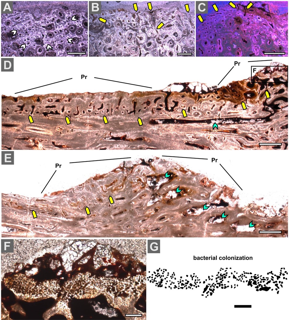 Os cientistas brasileiros esclareceram como a inflamação no dinossauro evoluiu até a formação dos caroços e identificaram, até mesmo, o momento em que a ferida se abriu e foi colonizada por bactérias (na imagem). — Foto: Tito Aureliano, Carolina S.I.Nascimento, Marcelo A.Fernandes, Fresia Ricardi-Branco, Aline M.Ghilardi