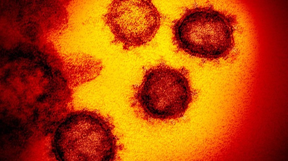 Imagem do novo coronavírus — Foto: G1