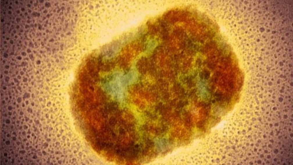 Vírus da varíola dos macacos, identificado pela primeira vez em duas décadas nos EUA — Foto: Science Photo Library via BBC