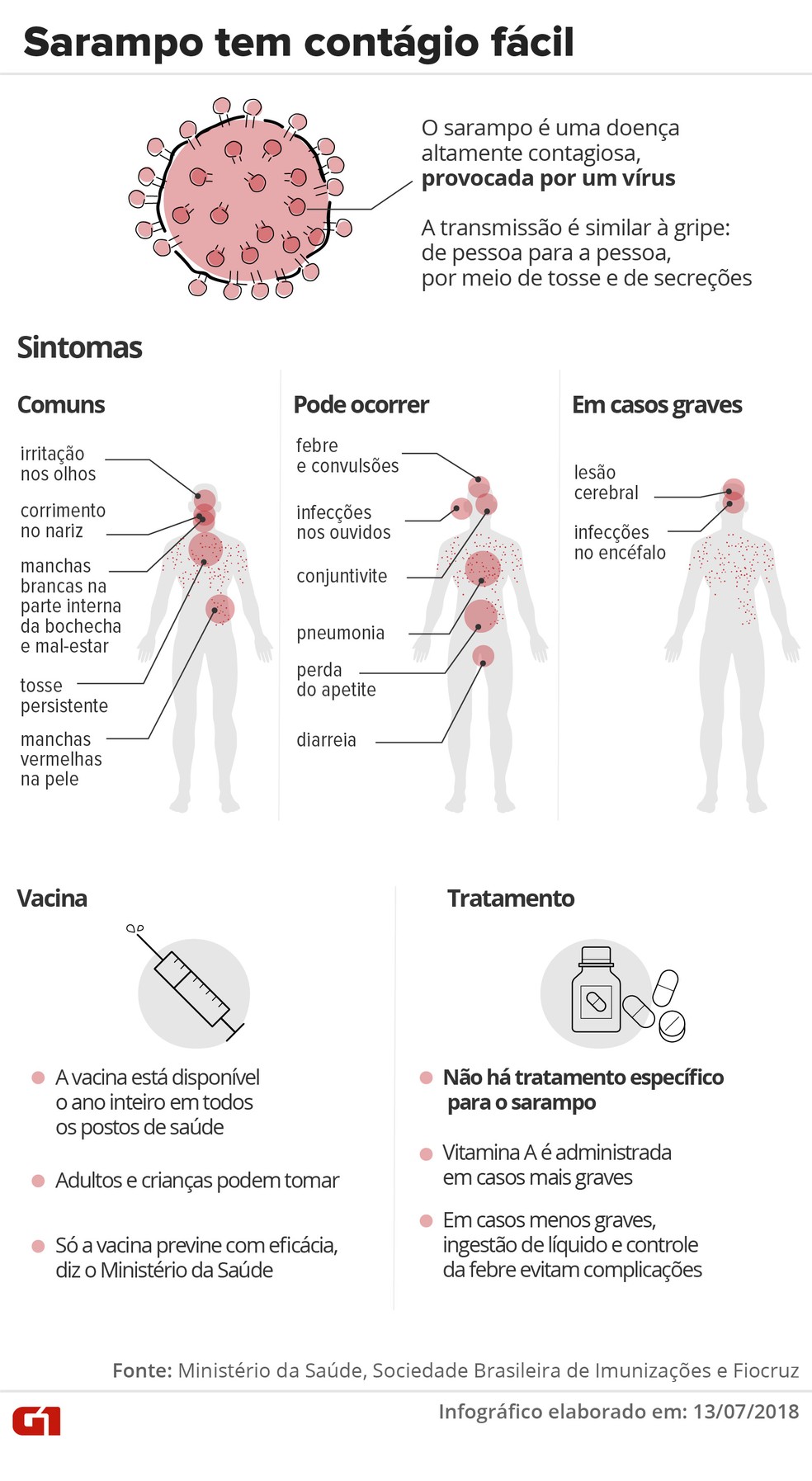 Entenda o que Ã© sarampo, quais os sintomas, como Ã© o tratamento e quem deve se vacinar (Foto: Infografia: Karina Almeida/G1)