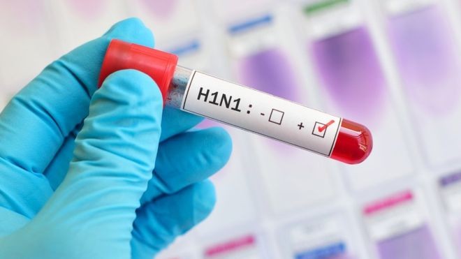 BBC: A pandemia de H1N1 afetou mais de 200 países entre 2009 e 2010 (Foto: GETTY IMAGES VIA BBC)