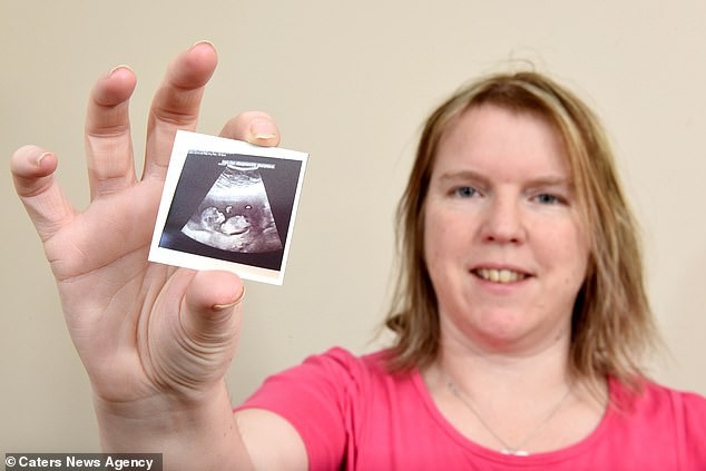 Kate passou por 18 abortos para ter seus cinco filhos (Foto: Reprodução/Daily Mail)