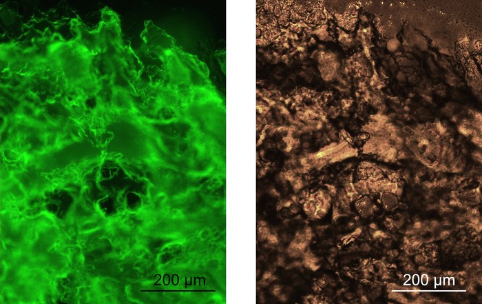 O gel corado om um corante fluorescente que se liga às estruturas amiloides.  (Foto: Nature Communications)