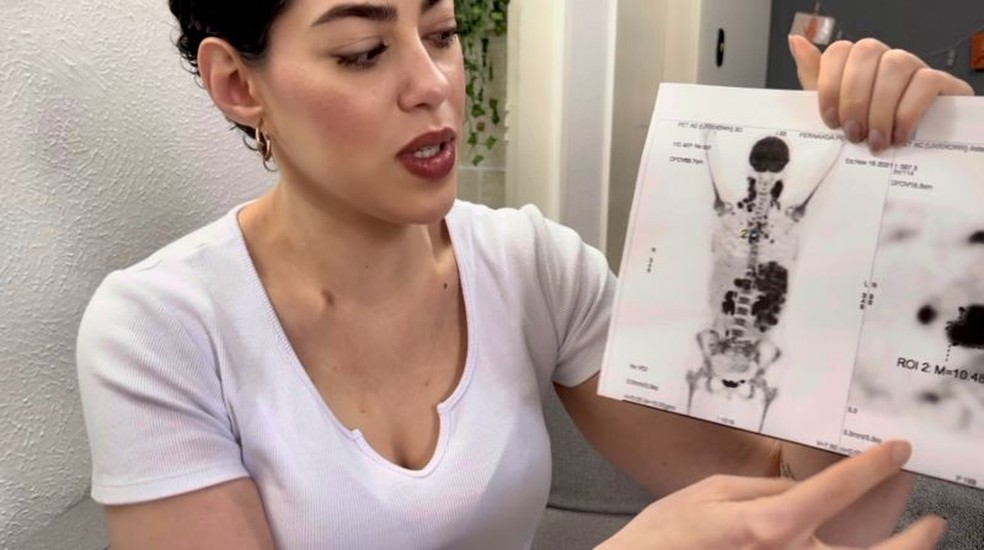 Por meio de um exame de imagem, Fernanda descobriu a gravidade da condição — Foto: Arquivo Pessoal/Via BBC