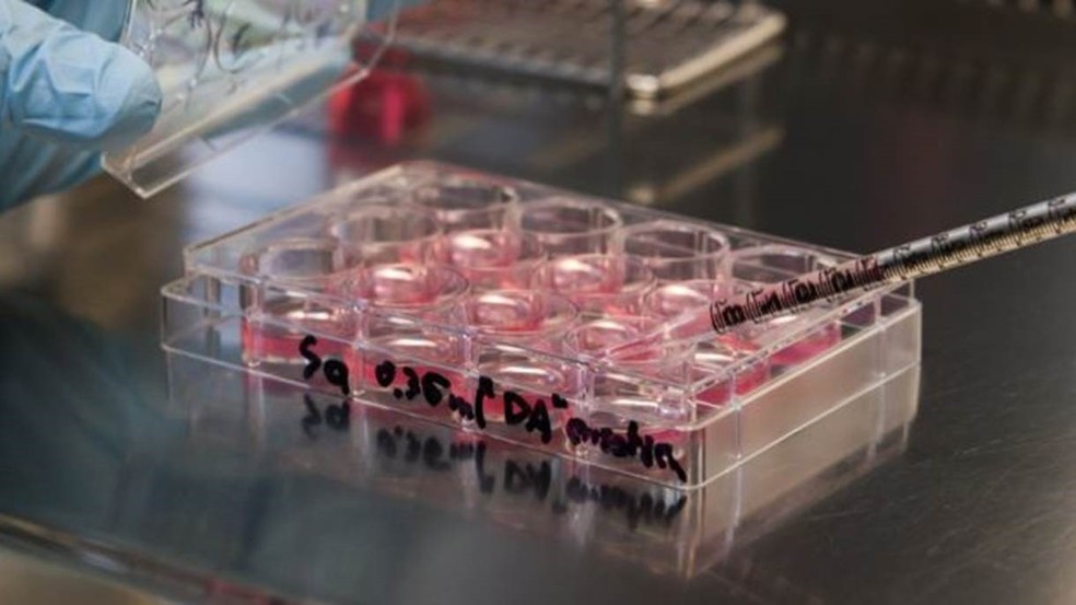 Estudo de células tronco — Foto: Getty Images via BBC