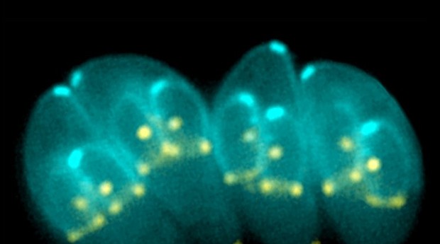 O protozoário Toxoplasma gondii está presente em fezes de gatos, águas contaminadas e comidas cruas (Foto: Reprodução)