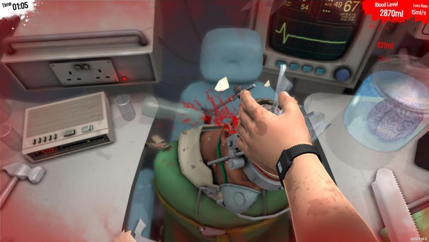 G1 - Casal brasileiro cria game 'Surgeon Simulator', que faz