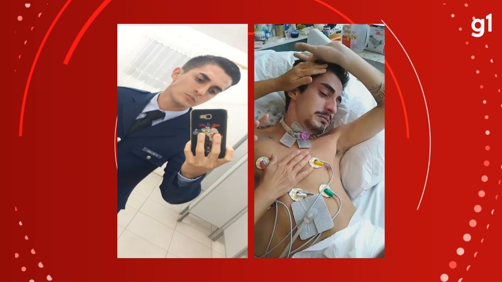 Alexandre Moraes de Lara, de 28 anos, antes e depois de superdosagem em hospital de Porto Alegre — Foto: Arquivo pessoal