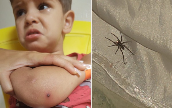 Menino E Internado Apos Ser Picado Por Aranha Em Aparecida De Goiania Goias G1
