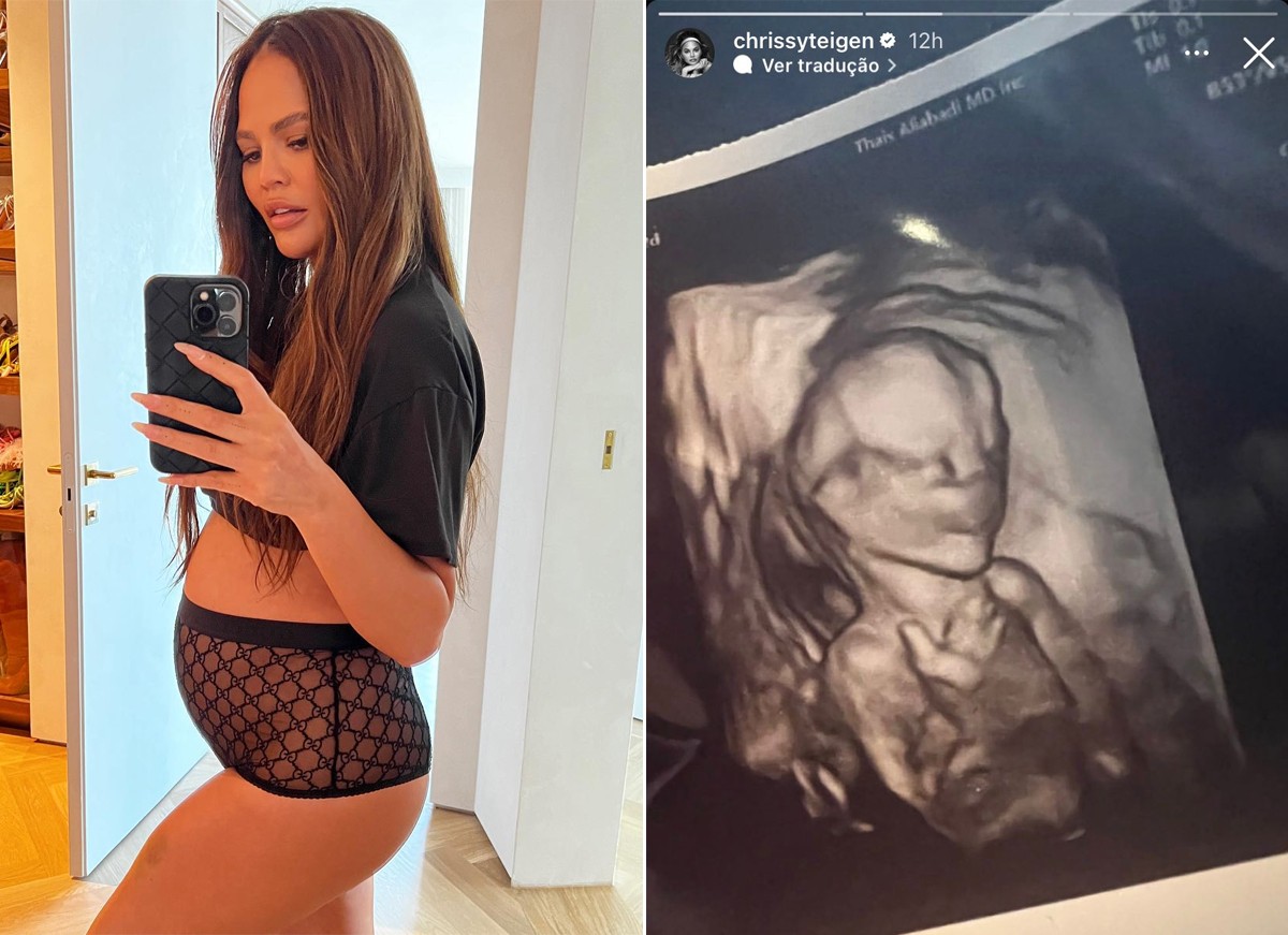 Chrissy Teigen anunciou recentemente que espera novo bebê com John Legend (Foto: Reprodução / Instagram)