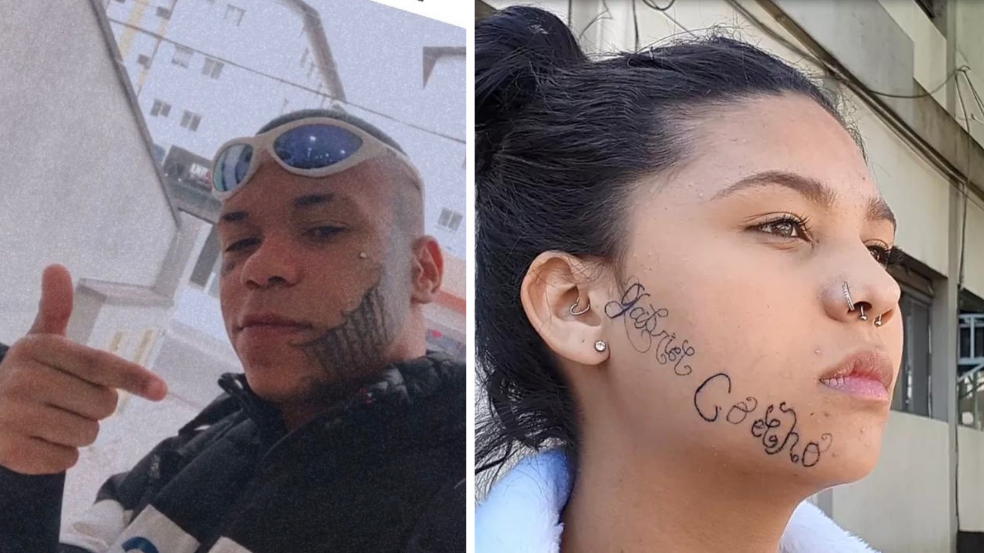 'Me sinto livre', diz jovem ao remover tatuagem feita no rosto pelo ex-namorado