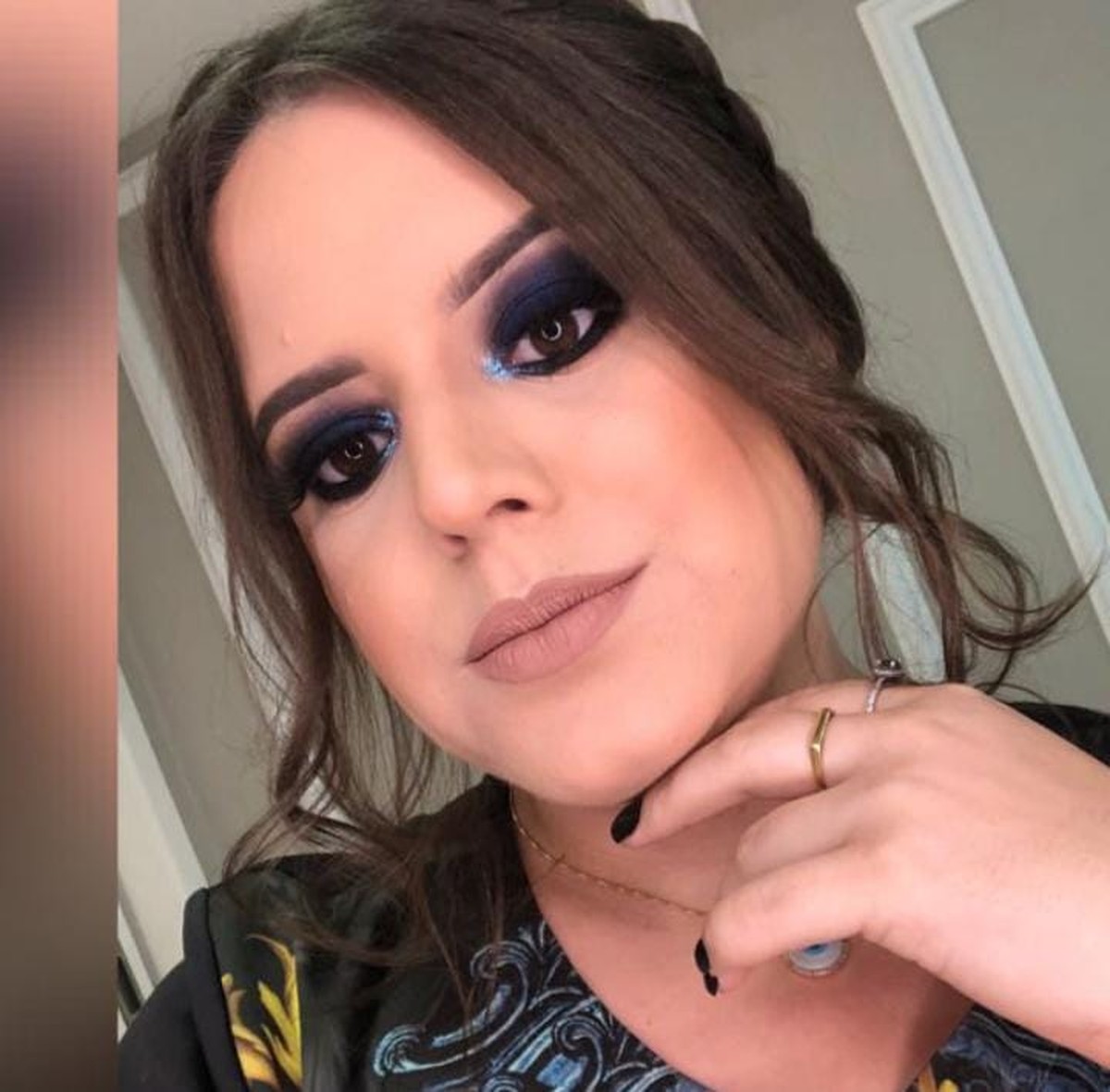 Jovem de 24 anos morre vítima da Covid-19 em Campos, no RJ