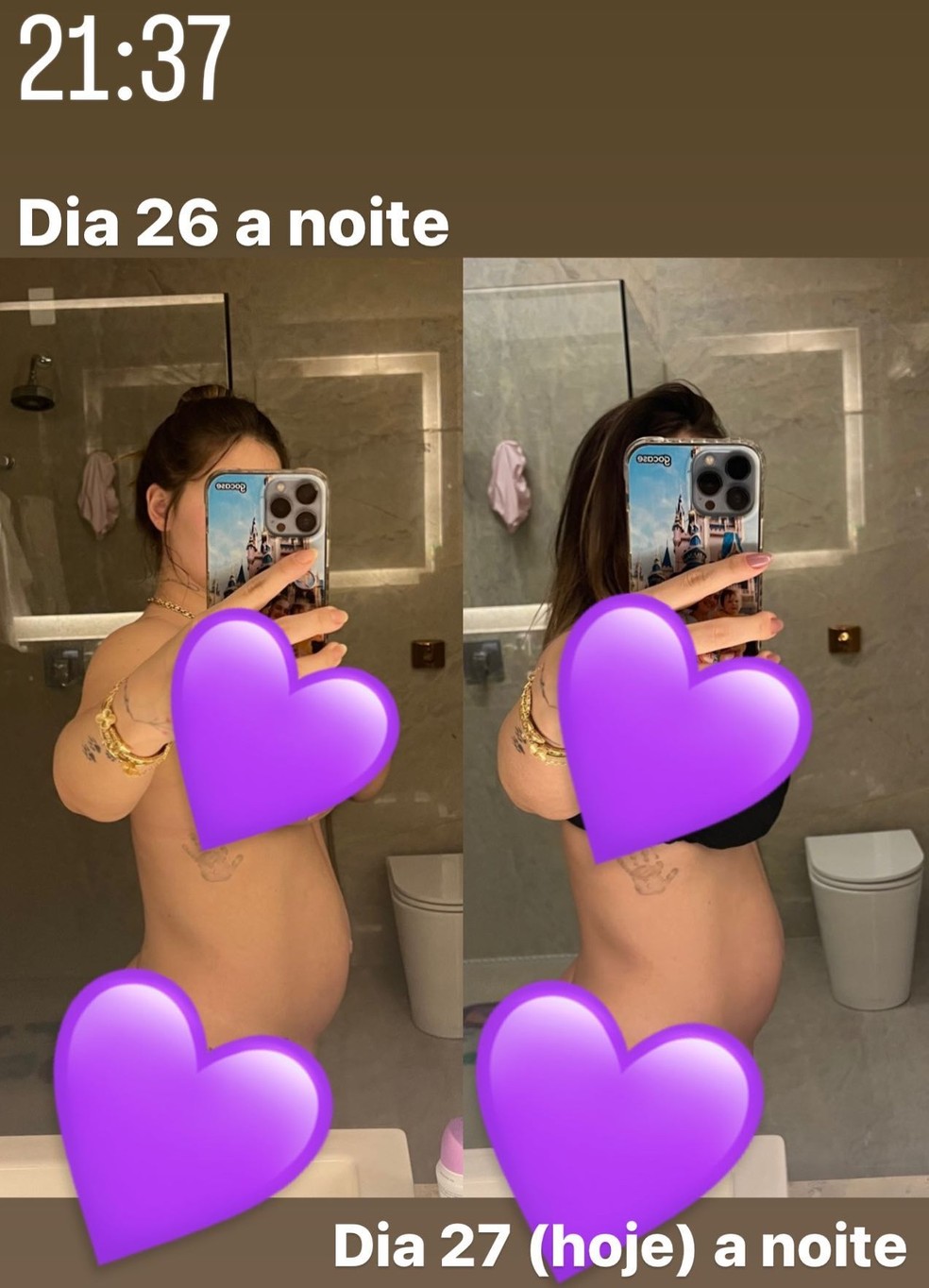 Virginia Fonseca mostra mudanças na barriga após segundo parto — Foto: Reprodução/Instagram