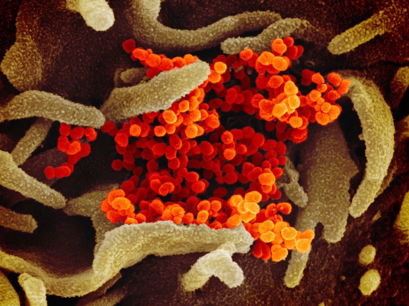 Os picos na superfície do organismo dão esse nome a essa família de vírus, pois corona significa "coroa" em latim (Foto: NIAID-RML)