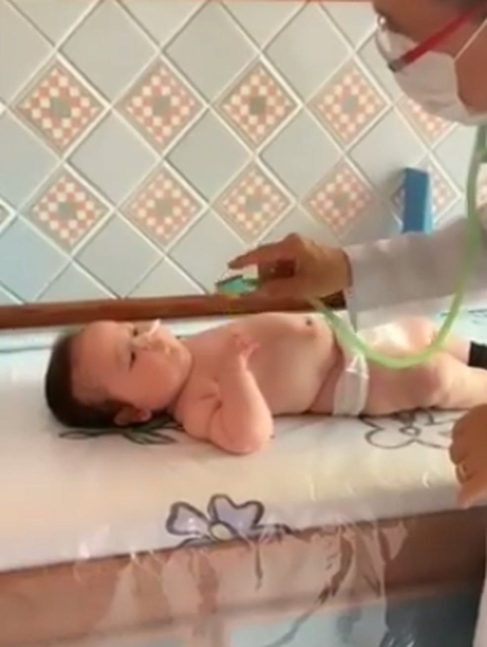 José Antônio, de 6 meses, se alimento por sonda — Foto: Instagram/Reprodução