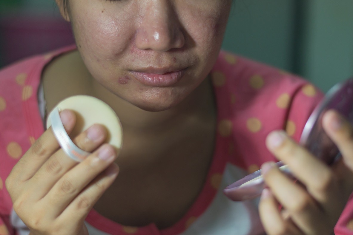 Puberdade antes da hora?