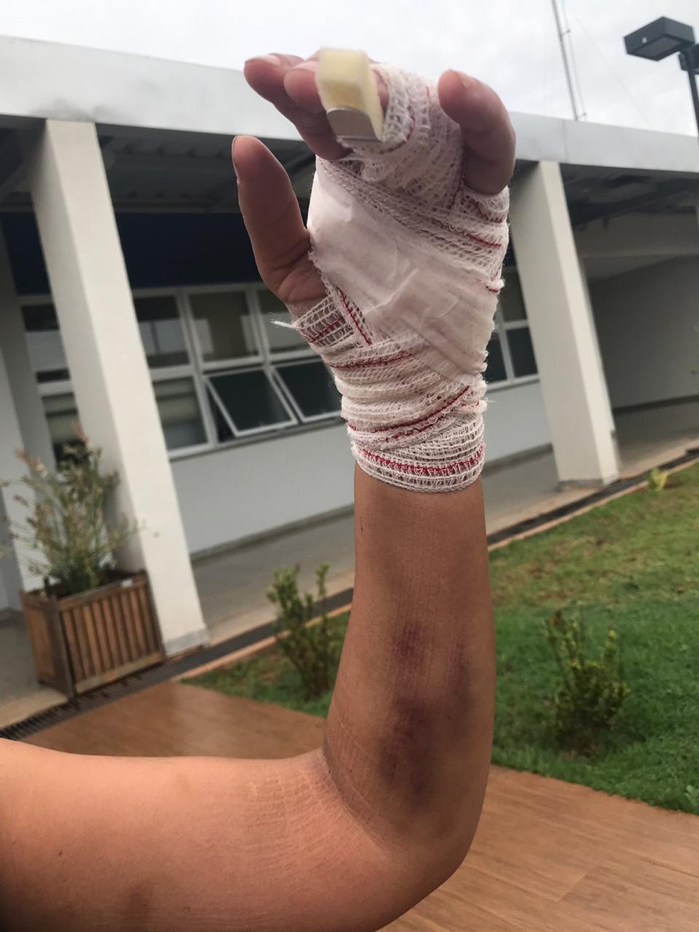 Mulher foi agredida ao flagrar companheiro com outra em MS â Foto: ClÃ¡udia Gaigher/TV Morena