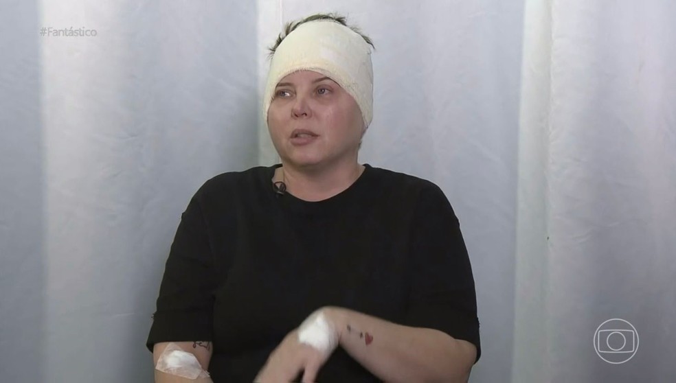 Isabel Martins da Costa sobreviveu à queda de cânion em Capitólio — Foto: Reprodução/TV Globo 