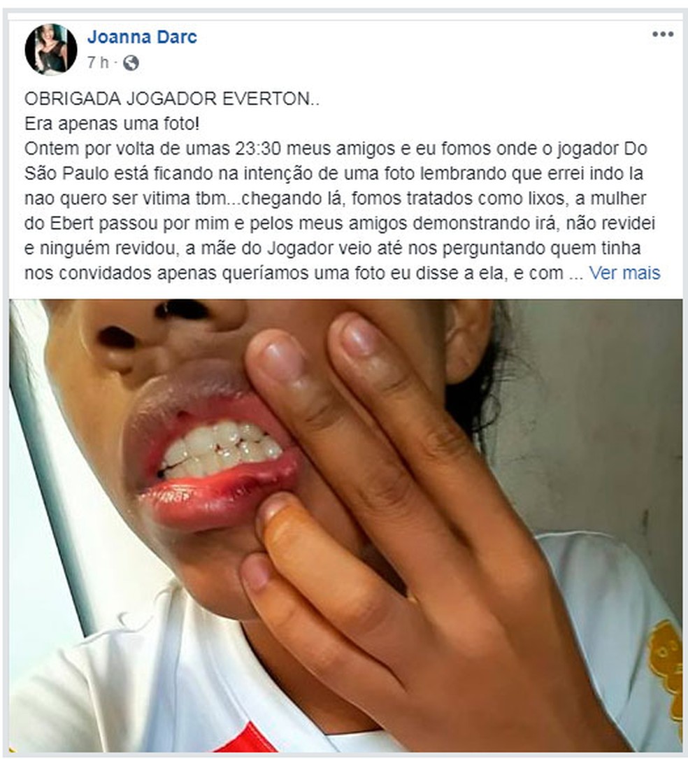 Garota de 21 anos diz ter sido agredida por Everton, do São Paulo; post já foi apagado por ela — Foto: reprodução