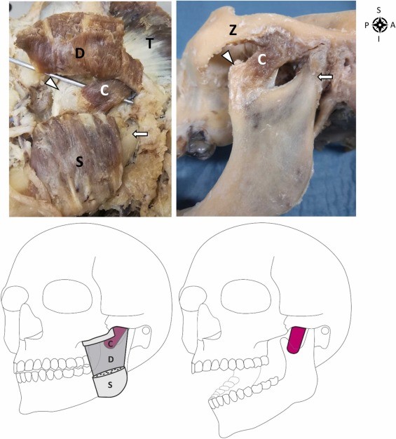 Pesquisadores descobriram uma camada mais funda do músculo masseter  (Foto: Szilvia E.Mezey et.al )