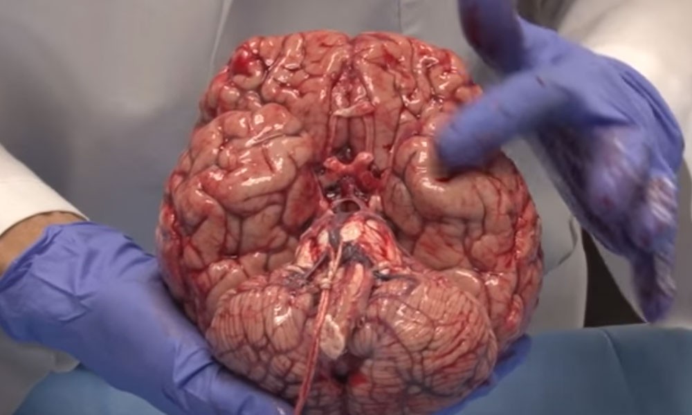 Cérebro (Foto: Reprodução/ YouTube)