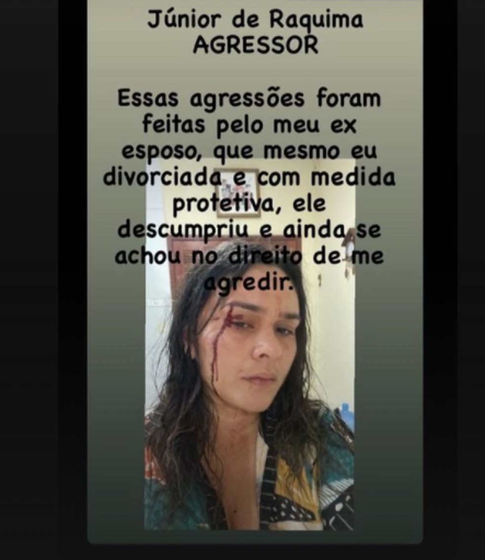 Ex-candidato a prefeito de cidade do Maranhão é suspeito de agredir a ex-mulher: “ele não aceitou a separação” — Foto: Divulgação/Redes sociais