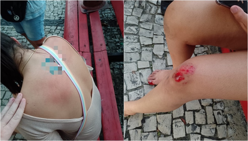 Jovem afirma que caiu e se feriu após levar dois tapas nas costas dados pelo coreógrafo durante discussão em trailer de lanches na Praia de Iracema, em Fortaleza. — Foto: Arquivo pessoal
